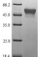 Mycoplasma pneumoniae Putative Xaa-Pro aminopeptidase (pepP) Recombinant Protein - BioCrest Sci