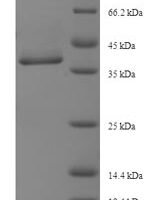 Human MAP3K7 C-terminal-like protein (MAP3K7CL) Recombinant Protein - BioCrest Sci