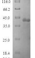 Human Ribonuclease P protein subunit p20 (POP7) Recombinant Protein - BioCrest Sci