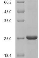 Macaca fascicularis Interleukin-2 (IL2) Recombinant Protein - BioCrest Sci