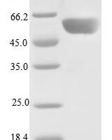 Human Serine/threonine-protein phosphatase 2A 55 kDa regulatory subunit B gamma isoform (PPP2R2C) Recombinant Protein, N-10His/C-Myc, aa 1–447, E.coli - BioCrest Sci
