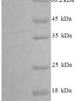 Mouse C-C motif chemokine 7 (Ccl7), partial Recombinant Protein - BioCrest Sci