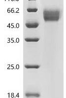 Human Interleukin-1 receptor type 1 (IL1R1), partial Recombinant Protein - BioCrest Sci