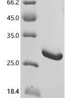 Mouse Proteasome subunit beta type-8 (Psmb8) Recombinant Protein - BioCrest Sci