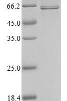 Human coronavirus HKU1 Nucleoprotein (N) Recombinant Protein, N-10His/C-Myc, aa 1–441, Mammalian cell - BioCrest Sci