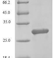 Mouse Transcription factor MafK (Mafk) Recombinant Protein, N-His - BioCrest Sci