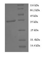 Human General transcription factor IIH subunit 5 (GTF2H5) Recombinant Protein - BioCrest Sci
