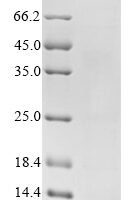 Human Peptide YY (PYY), partial Recombinant Protein - BioCrest Sci