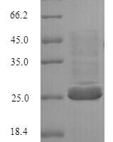 Human Butyrophilin subfamily 3 member A2 (BTN3A2), partial Recombinant Protein, N-His - BioCrest Sci