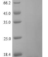 Human Trefoil factor 1 (TFF1) Recombinant Protein, N-His - BioCrest Sci