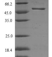 Human Ras-related protein Rab-17 (RAB17) Recombinant Protein - BioCrest Sci