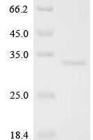Human Lymphocyte antigen 6 complex locus protein G6f (LY6G6F), partial Recombinant Protein - BioCrest Sci