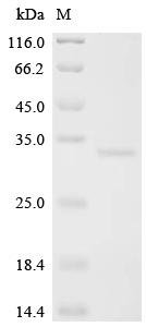 Human Lymphocyte antigen 6 complex locus protein G6f (LY6G6F), partial Recombinant Protein, Homo sapiens (Human), E.coli, C-terminal 6xHis-tagged, 30.7 kDa, purity >≥ 90% as determined by SDS-PAGE.