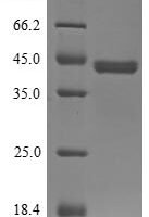 Pig Interleukin-4 receptor subunit alpha (IL4R), partial Recombinant Protein - BioCrest Sci