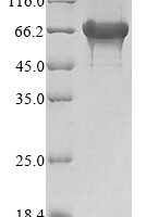 Saccharomyces cerevisiae Alpha-1,3-mannosyltransferase MNT3 (MNT3), partial Recombinant Protein, N-His - BioCrest Sci