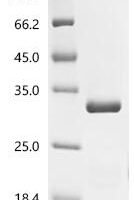 Danio rerio Fatty acid-binding protein 10-A, liver basic (fabp10a) Recombinant Protein, N-His-SUMOstar - BioCrest Sci