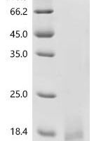 Human Insulin-like growth factor I (IGF1) Recombinant Protein, C-His - BioCrest Sci