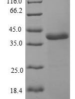 Human Myosin light chain 1/3, skeletal muscle isoform (MYL1) Recombinant Protein - BioCrest Sci