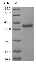 Human Myosin light chain 1/3, skeletal muscle isoform (MYL1) Recombinant Protein, Homo sapiens (Human), E.coli, N-terminal GST-tagged, 43.7 kDa, purity >≥ 90% as determined by SDS-PAGE.