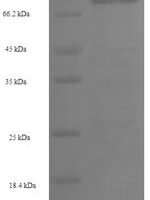 Human Polypeptide N-acetylgalactosaminyltransferase 14 (GALNT14) Recombinant Protein, N-His-SUMO - BioCrest Sci