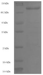 Human Polypeptide N-acetylgalactosaminyltransferase 14 (GALNT14) Recombinant Protein, N-His-SUMO, Homo sapiens (Human), E.coli, N-terminal 6xHis-SUMO-tagged, 80.3 kDa, purity >≥ 90% as determined by SDS-PAGE.