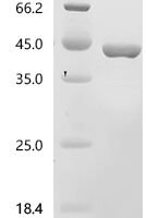 Pig Uricase (UOX) Recombinant Protein, C-His - BioCrest Sci