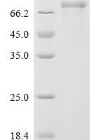 Human Cadherin-9 (CDH9), partial Recombinant Protein - BioCrest Sci