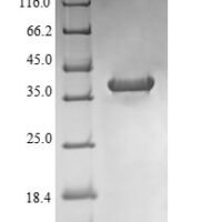 Rat NADPH oxidase 4 (Nox4), partial Recombinant Protein, N-His-B2M - BioCrest Sci