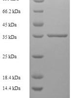 Human Zinc finger matrin-type protein 5 (ZMAT5) Recombinant Protein - BioCrest Sci