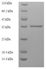 Human Zinc finger matrin-type protein 5 (ZMAT5) Recombinant Protein, Homo sapiens (Human), E.coli, N-terminal 6xHis-SUMO-tagged, 36.0 kDa, purity >≥ 90% as determined by SDS-PAGE.