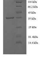 Rabbit Tissue factor pathway inhibitor (TFPI) Recombinant Protein, N-His, aa 25–300a, E.coli - BioCrest Sci