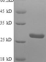 Human Protein S100-A4 (S100A4) Recombinant Protein - BioCrest Sci