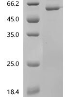 Human Erythropoietin receptor (EPOR), partical Recombinant Protein - BioCrest Sci