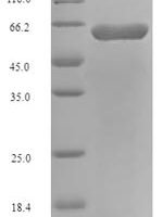 Escherichia coli O157:H7 Long-chain fatty acid transport protein (fadL) Recombinant Protein - BioCrest Sci