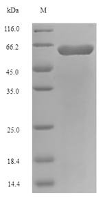 Escherichia coli O157:H7 Long-chain fatty acid transport protein (fadL) Recombinant Protein, Escherichia coli O157:H7, E.coli, N-terminal 6xHis-SUMO-tagged, 61.9 kDa, purity >≥ 90% as determined by SDS-PAGE.