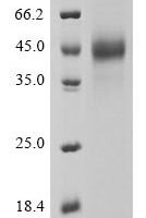 Human coronavirus OC43 Spike glycoprotein (S), partial Recombinant Protein, C-His-Myc - BioCrest Sci