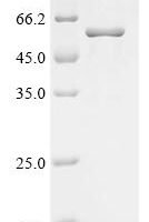 Newcastle disease virus Phosphoprotein (P) Recombinant Protein - BioCrest Sci