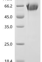 Nepenthes gracilis Aspartic proteinase nepenthesin-2 (nep2) Recombinant Protein, C-10His, aa 25–438, Yeast - BioCrest Sci