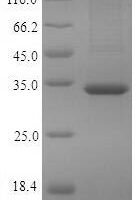 Human Pyridoxal phosphate phosphatase (PDXP) Recombinant Protein, C-9xHis - BioCrest Sci