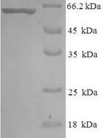 Escherichia coli Periplasmic serine endoprotease DegP (degP) Recombinant Protein - BioCrest Sci