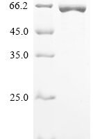 Human ATP-dependent RNA helicase DDX19B (DDX19B) Recombinant Protein - BioCrest Sci