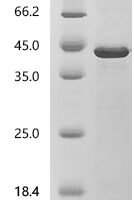 Human Protein lin-28 homolog B (LIN28B) Recombinant Protein, C-His - BioCrest Sci