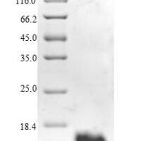 Human Replication factor C subunit 1 (RFC1), partial Recombinant Protein, N-10His/C-Myc, aa 402–492, E.coli - BioCrest Sci