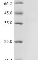 Severe acute respiratory syndrome coronavirus 2 Spike glycoprotein (S) (G75V,T76I,SYLTPGD247-253del,L452Q,F490S,D614G,T859N), partial Recombinant Protein - BioCrest Sci