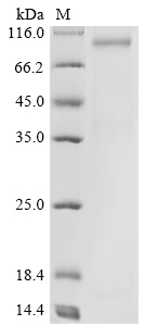 Severe acute respiratory syndrome coronavirus 2 Spike glycoprotein (S) (G75V,T76I,SYLTPGD247-253del,L452Q,F490S,D614G,T859N), partial Recombinant Protein, Severe acute respiratory syndrome coronavirus 2 (2019-nCoV) (SARS-CoV-2), Mammalian cell, N-terminal 10xHis-tagged and C-terminal Flag-tagged, 78.9 kDa, purity >≥ 90% as determined by SDS-PAGE.