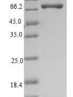 Synechocystis sp.Ribonuclease J (rnj) Recombinant Protein - BioCrest Sci
