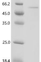 Mouse Pro-neuregulin-3, membrane-bound isoform (Nrg3), partial Recombinant Protein - BioCrest Sci