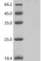 Macaca fascicularis Heat shock protein HSP 90-beta (HSP90AB1) Recombinant Protein, C-10His, aa 1–724, Mammalian cell - BioCrest Sci