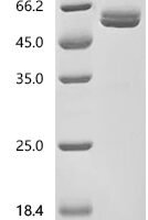 Macaca mulatta Erythropoietin receptor (EPOR), partial Recombinant Protein, C-hFc1 - BioCrest Sci