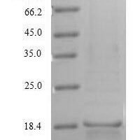 Human CD70 antigen (CD70), partial Recombinant Protein, N-His - BioCrest Sci